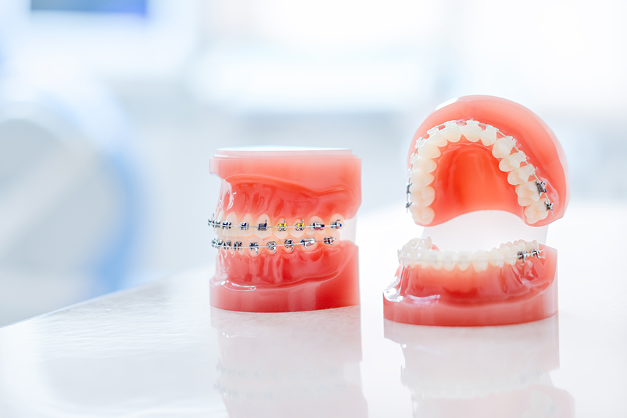 正歯科治療にともなう一般的なリスク・副作用について